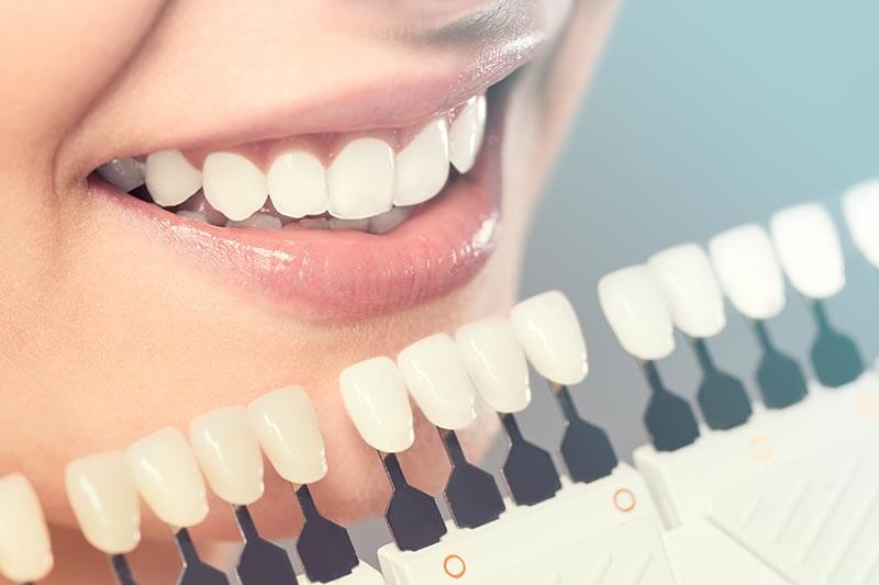 Cosmetic dentistry